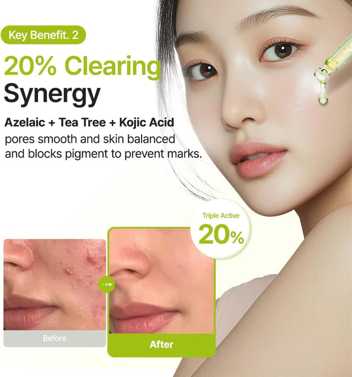 Azelaic Acid 10 Kojic Tea Tree Serum